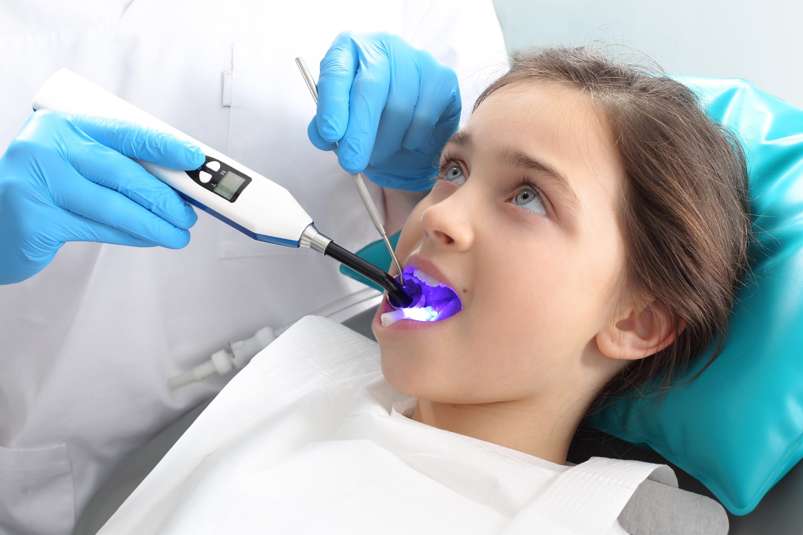 Dental Sealants Dental Sealants