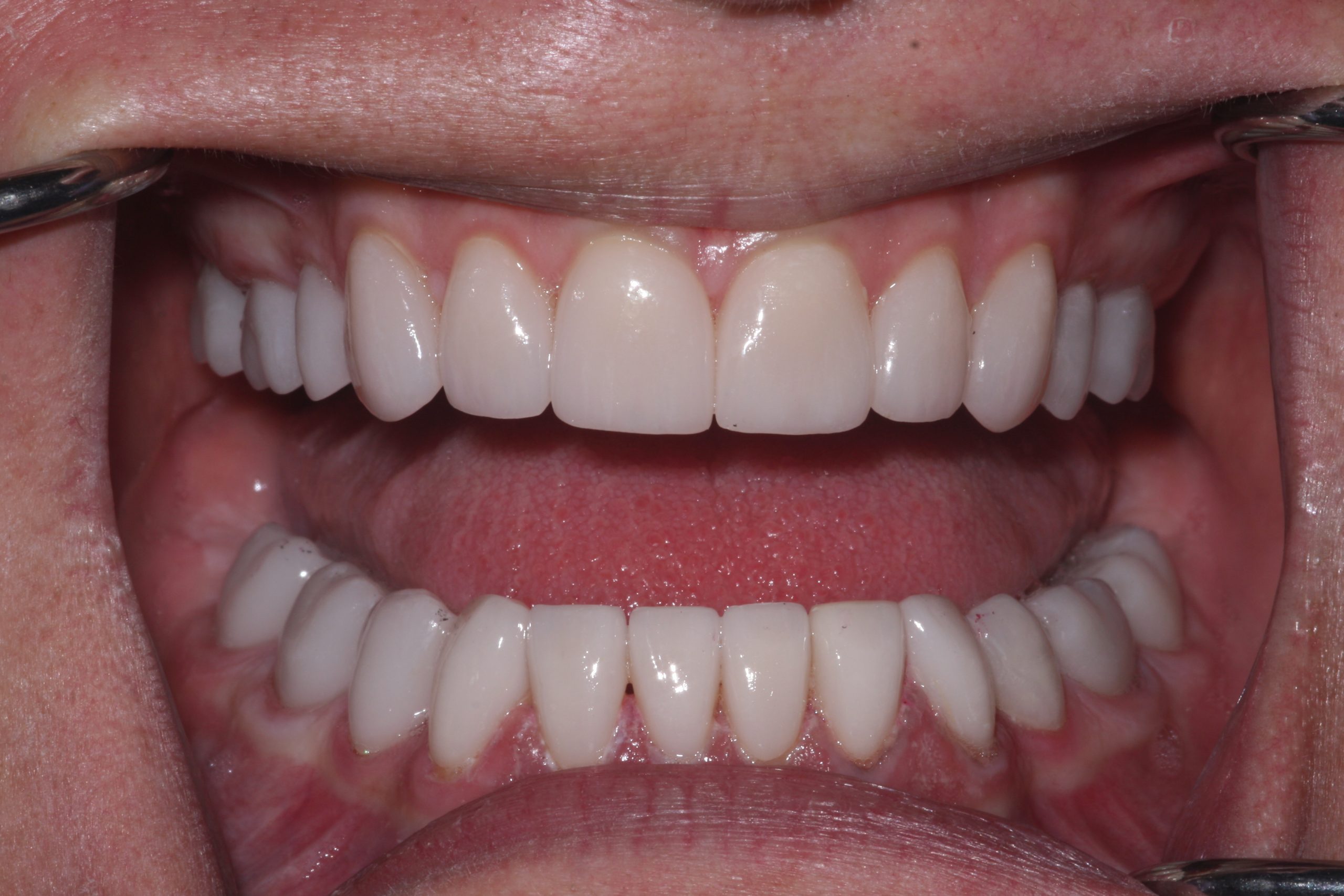 Success Stories 4 IMG 0882 1 scaled