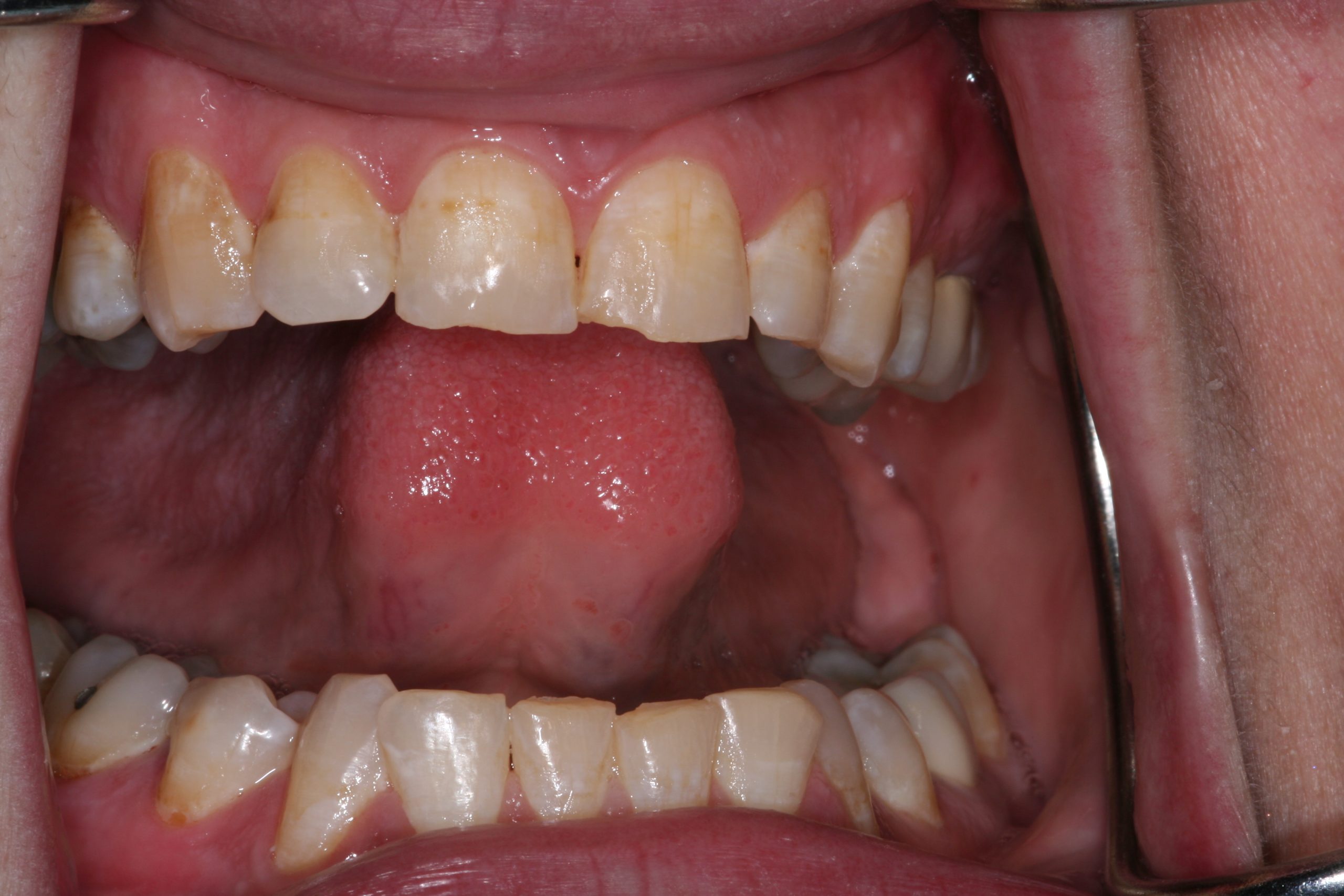 Success Stories 3 IMG 0883 scaled