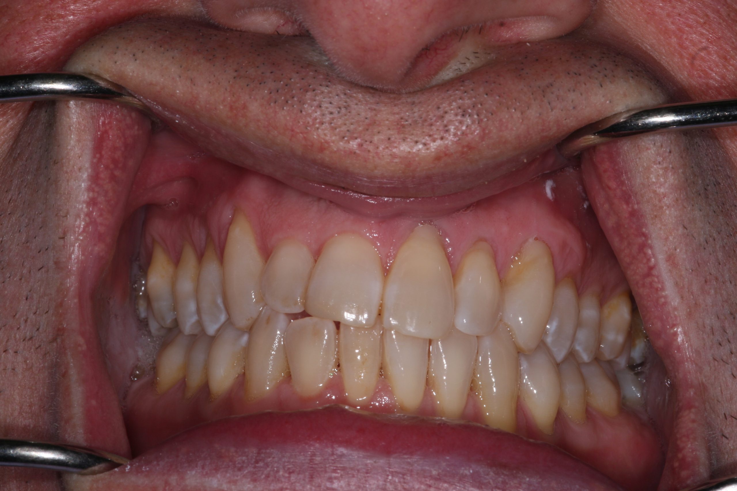 Success Stories 5 IMG 0885 scaled