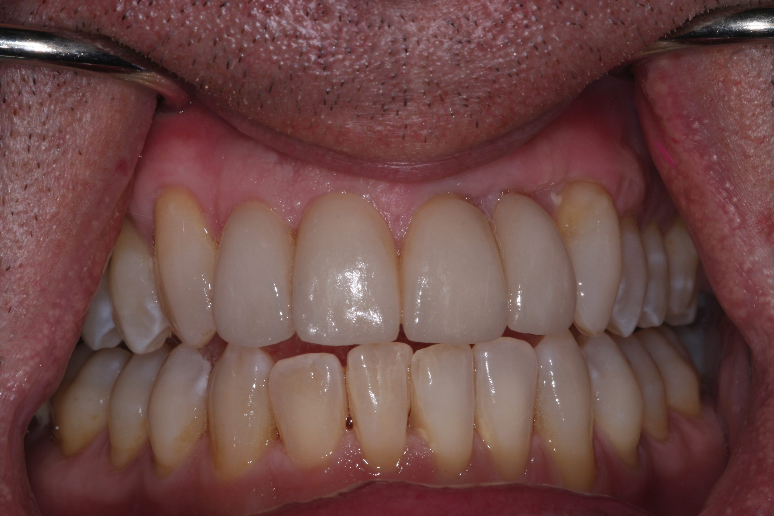 Success Stories 6 IMG 0886 scaled