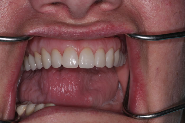 Success Stories 13 IMG 0925