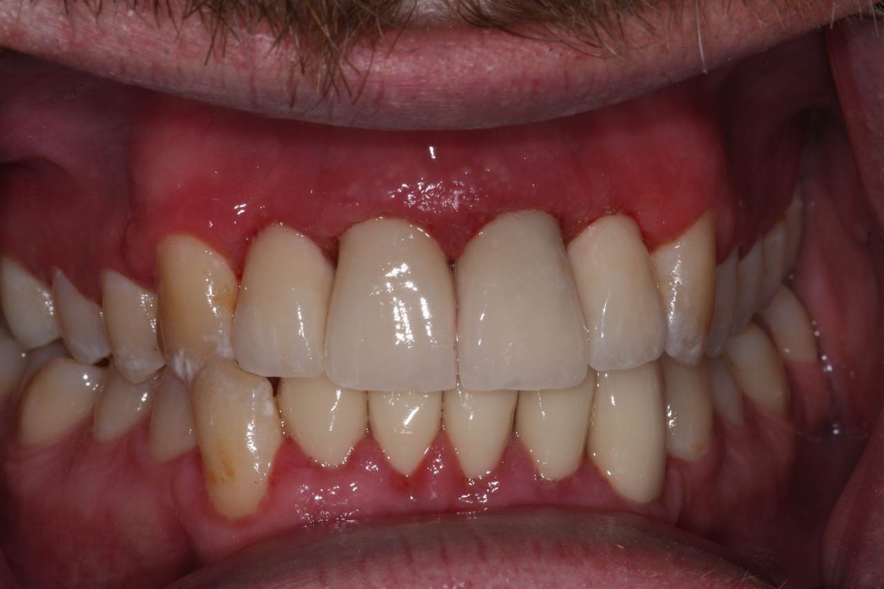 Success Stories 8 Restoration After an Accident 2