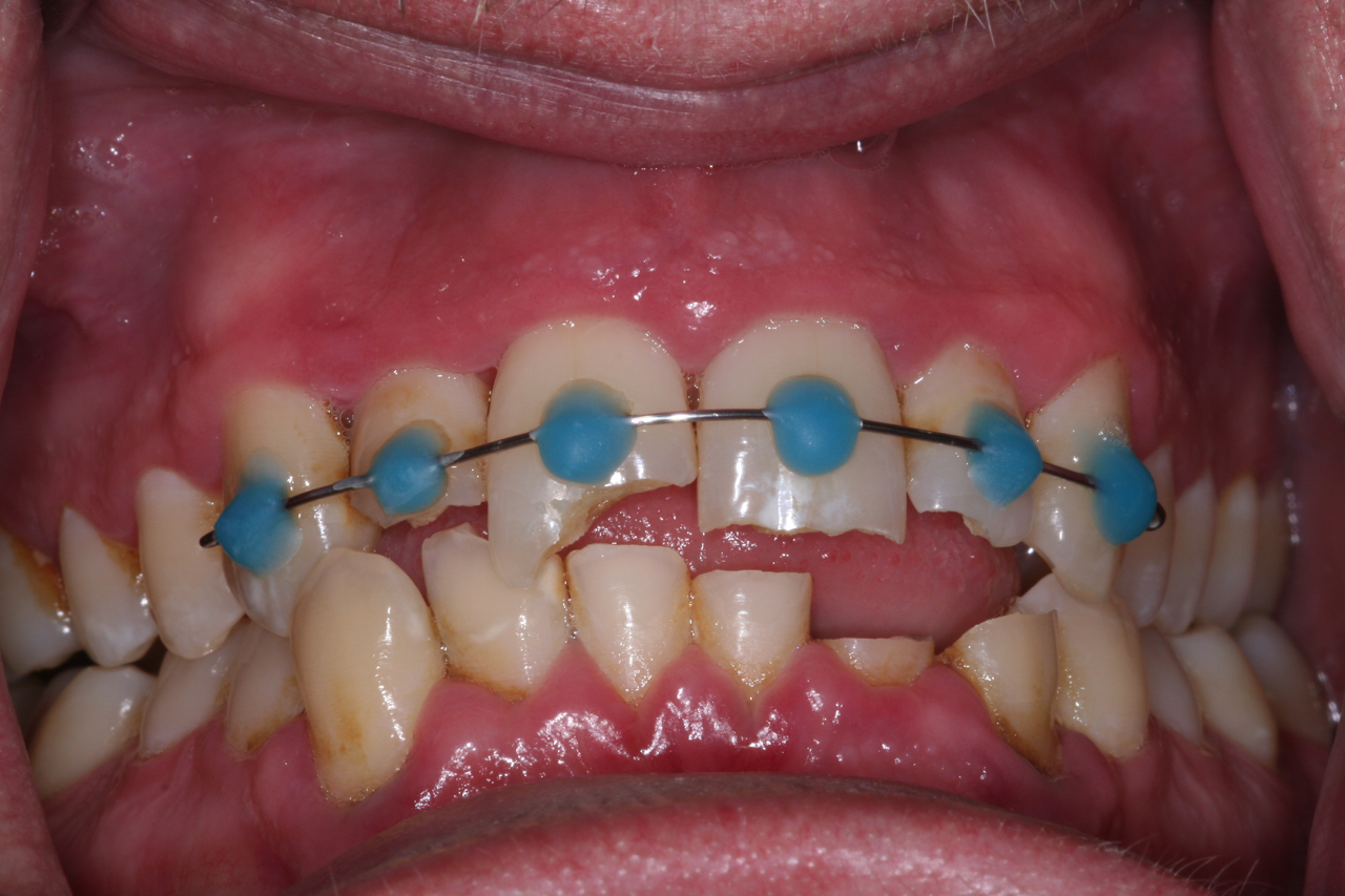 Success Stories 7 Restoration After an Accident